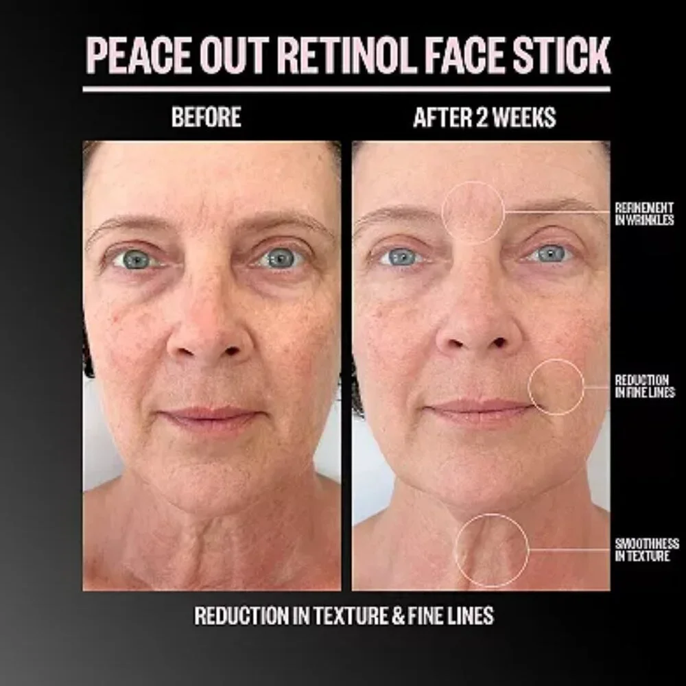 Peace Out Retinol Face Stick - NIB